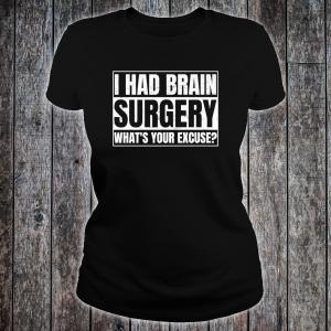 Agile necesita cerebro